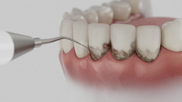 Trusted Root Canal Treatment service in Ocean City, NJ - Dentist Open Now